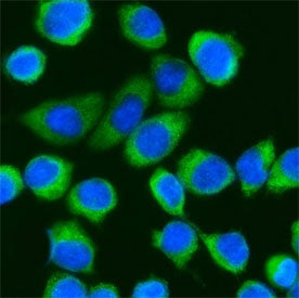 DDX3 Antibody (N-Terminal Region)