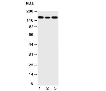 Western blot testing of IGF1R antibody and Lane 1: 293T; 2: A549; 3: MCF-7 cell lysate. Predicted mo