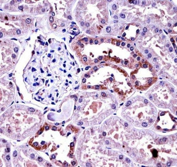 IHC testing of FFPE human kidney tissue with M-CSF antibody. HIER: steam section in pH6 citrate buff