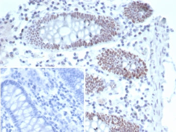 T-bet Antibody / Tbox-bet / TBX21