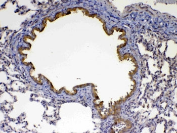 IHC testing of FFPE rat lung tissue with Factor D antibody at 1ug/ml. Required HIER: steam section i