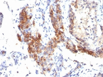 FOXP3 Antibody / Scurfin