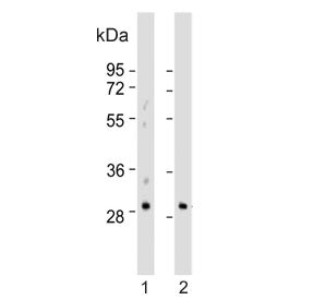 Western blot testing of human 1) A549 and 2) kidney lysate with Embryonic polyadenylate-binding prot