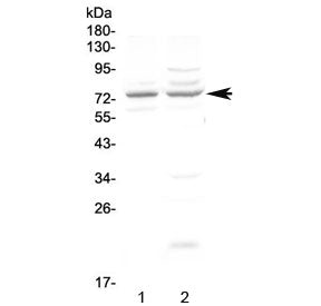 Western blot testing of human 1) COLO320 and 2) U-87 MG cell lysate with CHM antibody at 0.5ug/ml. P