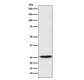 Western blot testing of human SW480 cell lysate with 15-PGDH antibody. Predicted molecular weight: ~