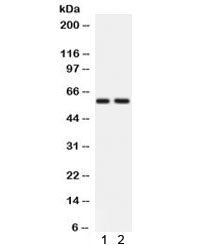 Western blot testing of 1) rat brain and 2) human HeLa lysate with ATG14L antibody. Expected/observe