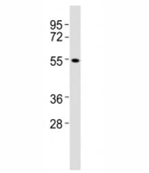 CB1 Antibody (Cannabinoid Receptor 1)