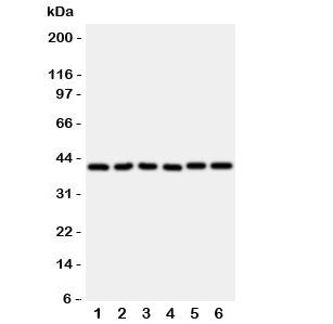 WISP1 Antibody