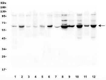 Western blot testing of 1) rat brain, 2) rat ovary, 3) mouse brain, 4) mouse testis, 5) mouse ovary,