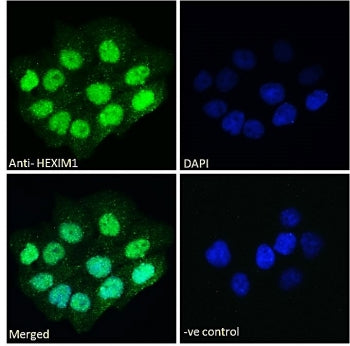Immunofluorescent staining of fixed and permeabilized human A431 cells with HEXIM1 antibody (green) 