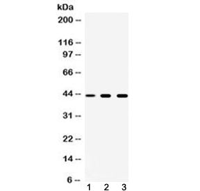 TAT Antibody / Tyrosine aminotransferase