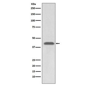 Western blot testing of human A549 cell lysate with HLA-A antibody. Predicted molecular weight ~41 k