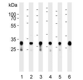 Western blot testing of human 1) A431, 2) HeLa, 3) HepG2, 4) MCF7, 5) U-251 MG and 6) mouse brain ly