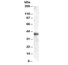 GOT1 Antibody