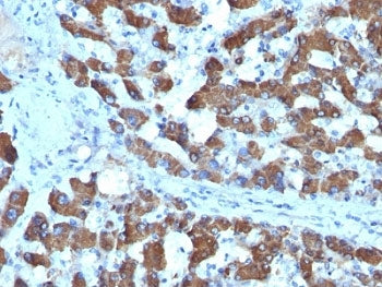 CPS1 Antibody