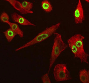 Immunofluorescent staining of FFPE human A549 cells with SP6 antibody (green) and Beta Tubulin mAb (