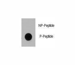 Dot blot analysis of phospho-Dnmt1 antibody. 50ng of phos-peptide or nonphos-peptide per dot were sp