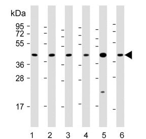 Western blot testing of 1) human 293T, 2) human A431, 3) mouse C2C12, 4) mouse NIH 3T3, 5) human bre