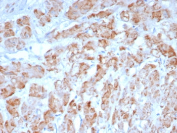 SMMHC Antibody / Smooth Muscle Myosin Heavy Chain
