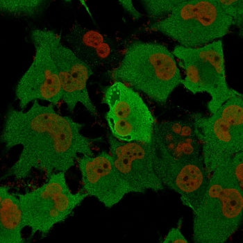 Immunofluorescent staining of permeabilized human T98G cells with recombinant PGP9.5 antibody cockta