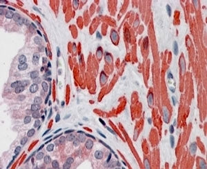 IHC staining of FFPE human prostate with VPS37C antibody at 4ug/ml. HIER: steamed with pH6 citrate b