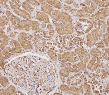 IHC testing of FFPE human kidney tissue with SERPINA6 antibody. HIER: steam section in pH6 citrate b