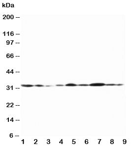 Western blot testing of Connexin 32 antibody and Lane 1: rat heart; 2: (r) heart; 3: (r) skeletal mu