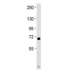 Western blot testing of mouse spleen tissue lysate with MPL antibody at 1:2000. Predicted molecular 