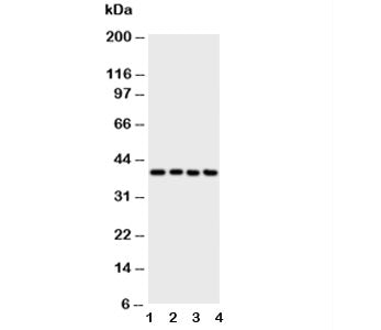 Western blot testing of ATF4 antibody and Lane 1: A431; 2: Raji; 3: CEM; 4: HUT cell lysate. Predict