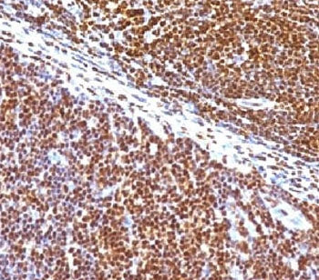 IHC staining of human tonsil with SUMO1 antibody (clone S1MT-2). Required HIER: boil tissue sections