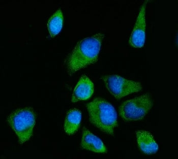 Immunofluorescent staining of FFPE human HeLa cells with RPS2 antibody (green) and DAPI nuclear stai