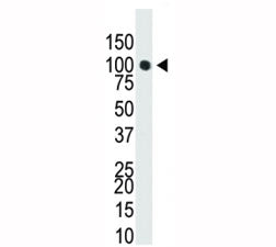 Western blot analysis of Dnmt3a antibody in T47-D cell lysate. Predicted molecular weight: 100-130 k