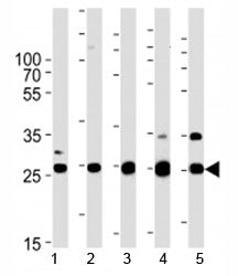 Sdhb Antibody