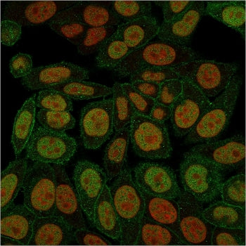 Immunofluorescent staining of PFA-fixed human HeLa cells with Annexin A1 antibody (green, clone ANXA
