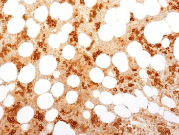 IHC testing of FFPE human bone marrow with CD71 / Transferrin Receptor antibody (clone TFRC/1818). R