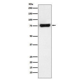 Western blot testing of human HeLa cell lysate with MTA2 antibody. Predicted molecular weight ~75 kD