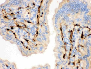 IHC testing of FFPE mouse intestine with FABP4 antibody. HIER: Boil the paraffin sections in pH 6, 1