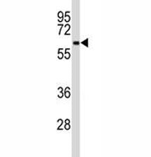 BECN1 Antibody