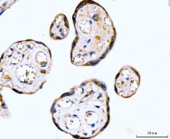 IHC staining of FFPE human placental tissue with RYR2 antibody. HIER: boil tissue sections in pH8 ED