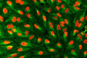SART1 Antibody