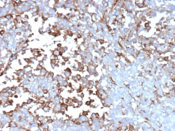 IHC staining of FFPE human adrenal gland tissue with Clusterin antibody (clone CLU/12059). HIER: boi
