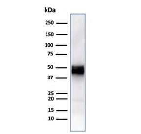 CD5 Antibody