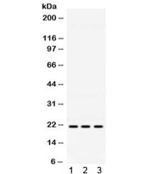 HRAS Antibody