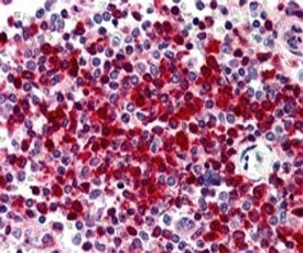 IHC testing of FFPE human spleen with DKC1 antibody at 5ug/ml. HIER: steamed with pH6 citrate buffer
