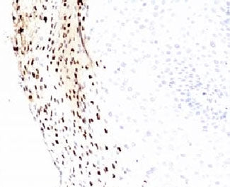 IHC testing of FFPE human cervix with HPV-16 L1 antibody (clone MCAPL1). FFPE testing requires secti