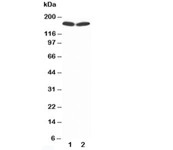 Western blot testing of nNOS antibody and Lane 1: rat brain lysate; 2: human MCF-7 lysate; Predicted