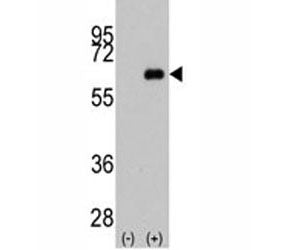 Western blot analysis of anti-c-Myc antibody and 293 cell lysate (2 ug/lane) either nontransfected (
