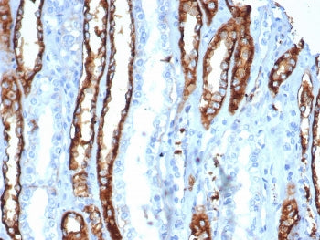 IL20RA Antibody / IL-20 receptor subunit alpha