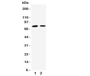 Transglutaminase 2 Antibody