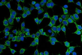 Immunofluorescent staining of FFPE human MCF7 cells with CD86 antibody (green) and DAPI nuclear stai